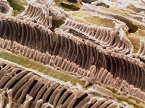 Xylem and parenchyma in Rhubarb stem Xylem and parenchyma in Rhubarb stem