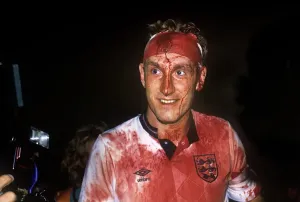 Terry Butcher Bloodied Print from 1989 World Cup Qualifier