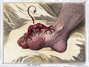The Gout. Etching, 1799, by James Gillray The Gout. Etching, 1799, by James Gillray