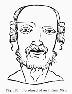 PHYSIOGNOMY, c1658. Forehead of an infirm man PHYSIOGNOMY, c1658. Forehead of an infirm man
