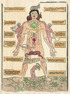 The Zodiac Man, the oldest printed bloodletting chart, showing the astrological signs for bloodletting The Zodiac Man, the oldest printed bloodletting chart, showing the astrological signs for bloodletting