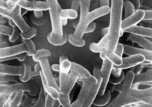 Electron Microscope Images Prints: Synaptic Knobs First Photographed