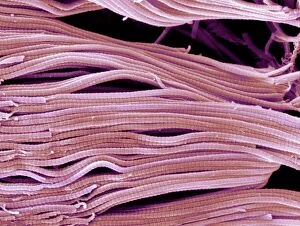 Images Dated 9th July 2009: Collagen, Scanning electron micrograph (SEM)