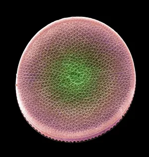 Colored scanning electron micrograph(SEM) Colored scanning electron micrograph(SEM)