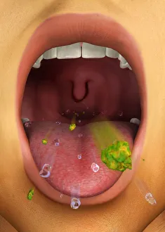Digital illustration showing cough reflex action through open mouth Digital illustration showing cough reflex action through open mouth
