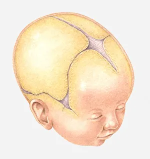 Illustration of Coronal Suture on head of newborn baby Illustration of Coronal Suture on head of newborn baby
