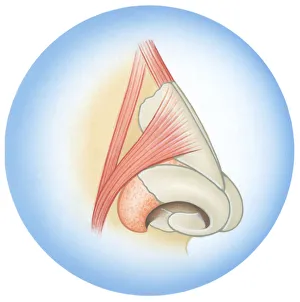 Illustration of septum cartilage inside human nose Illustration of septum cartilage inside human nose