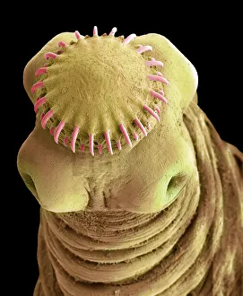 Tapeworm cysticercus, SEM Tapeworm cysticercus, SEM