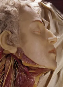 Model of a man whose throat has been cut (wax) Model of a man whose throat has been cut (wax)
