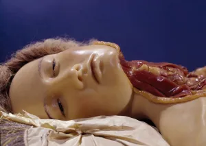 Model of a man whose throat has been cut (wax) Model of a man whose throat has been cut (wax)