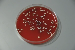 Bacteria from human skin grown on agar in the laboratory Bacteria from human skin grown on agar in the laboratory