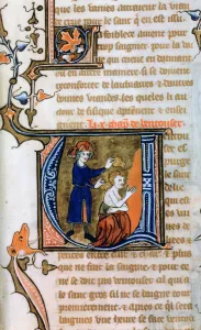 Cupping, 14th century Cupping, 14th century