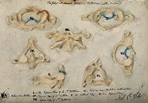 Cervical Vertebrae Print, 1852