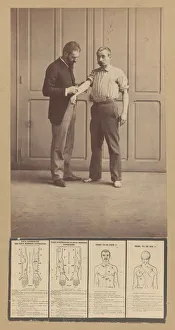 Alphonse Bertillon Prints: Notation of Scars, Schematic Drawings, ca. 1893. Creator: Alphonse Bertillon