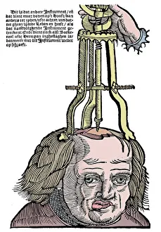 Medical Instrument History Prints: Trephination, 1593