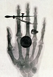 Wilhelm Roentgens X-ray photograph of his wifes hand, 1896. Artist: Wilhelm Conrad Rontgen Wilhelm Roentgens X-ray photograph of his wifes hand, 1896. Artist: Wilhelm Conrad Rontgen