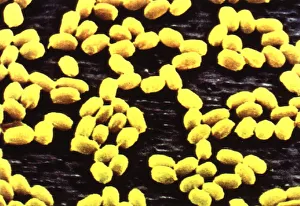 ANTHRAX UNDER ELECTRON MICROSCOPE - FEBRUARY 1998 FEATURE BY NATHAN YATES ON DR ANTHRAX UNDER ELECTRON MICROSCOPE - FEBRUARY 1998 FEATURE BY NATHAN YATES ON DR
