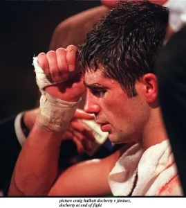 Drew Docherty of Scotland at the end of his WBO World Bantamweight title fight against Drew Docherty of Scotland at the end of his WBO World Bantamweight title fight against