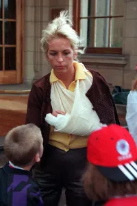 Sheryl Gascoigne with bruised marks made by Gazza wearing bandage sling round arm brown Sheryl Gascoigne with bruised marks made by Gazza wearing bandage sling round arm brown