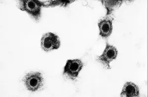 Transmission Electron Micrograph Print of Cytomegalovirus Virions