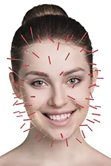 Alternative Medicine Prints: Close-up Acupuncture Therapy Print