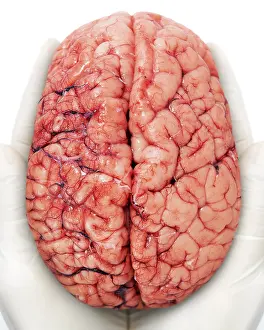 Brain Anatomy Prints: Human brain