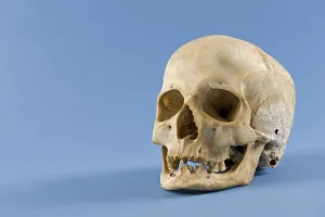 Human Skull Anatomy Prints: Human skull