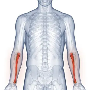 X Ray Examination Prints: Image converted using ifftoany