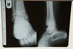 Doctor Patient Conversation Prints: Radiograph