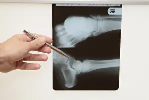 General Practitioner Advice Prints: Radiograph