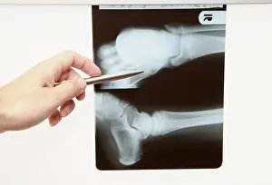 General Practitioner Advice Prints: Radiograph