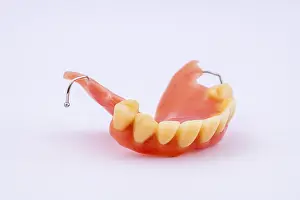 Dental Prosthesis Prints: Removable denture of an upper jaw
