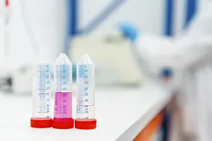 Medical Examination Process Prints: Three tubes with samples in the table of a laboratory with someone working on the background