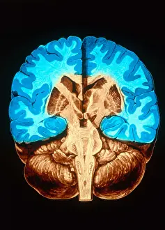 Human Brain Anatomy Prints: Brain, Coronal Section