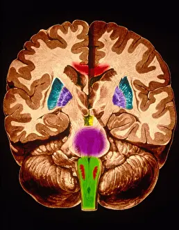 Human Nervous System Prints: Brain, Coronal Section