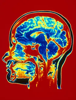 Brain MRI Scan Prints: Brain MRI