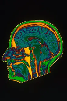 Brain MRI Scan Prints: Brain MRI