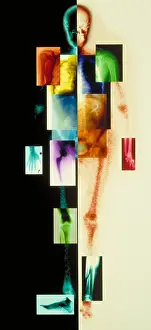 Medical Imaging Technology Prints: Composite of body