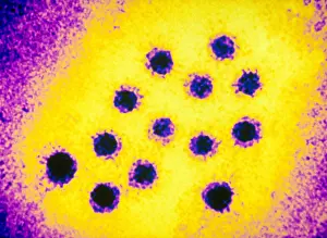 TEM Micrograph Prints: Hepatitis A Virus (TEM)