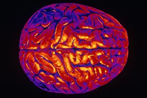 Human Brain Anatomy Prints: Human Brain