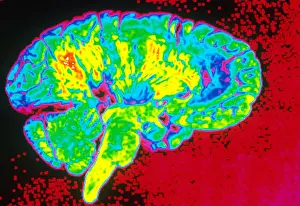 Human Brain Anatomy Prints: Human Brain
