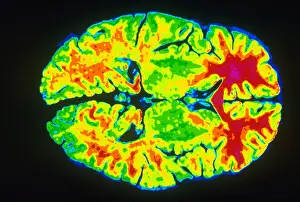 Magnetic Resonance Imaging Prints: Human Brain