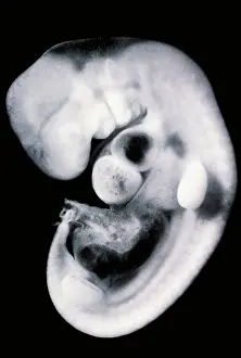 Scanning Electron Microscope Images Prints: Human embryo