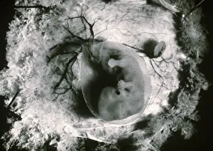 Human Embryo Development Prints: Human Embryo