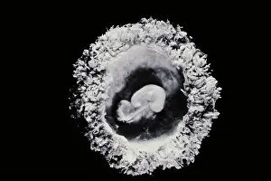 Scanning Electron Microscopy Prints: Human embryo