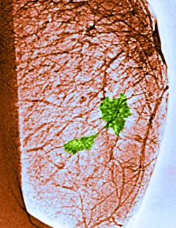 Medical Imaging Techniques Prints: Mammogram
