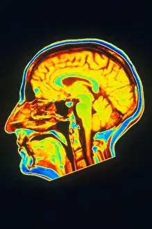 Normal Brain Anatomy Prints: MRI of Brain
