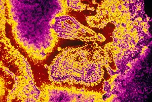 Medical Microbiology Images Prints: Mumps Virus (TEM)
