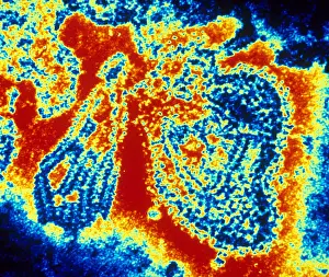 Medical Microbiology Images Prints: Mumps Virus (TEM)