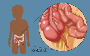 Normal Appendix Print, Anatomical Illustration